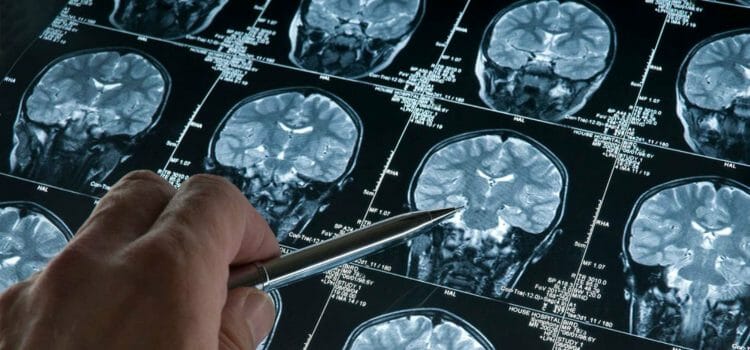 Neurociencia: qué estudia y su implicación en la psicología