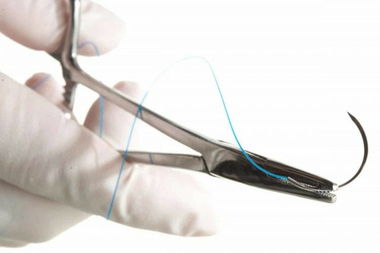 Sutura según filamentos
