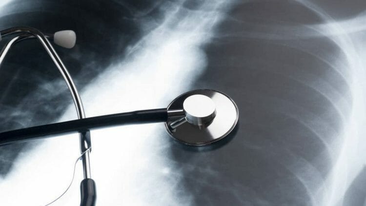 Principales enfermedades pulmonares graves