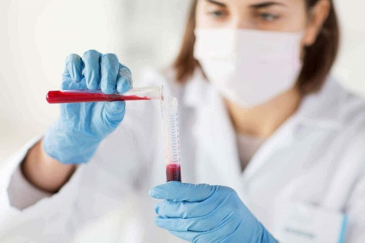 Test de ácido úrico