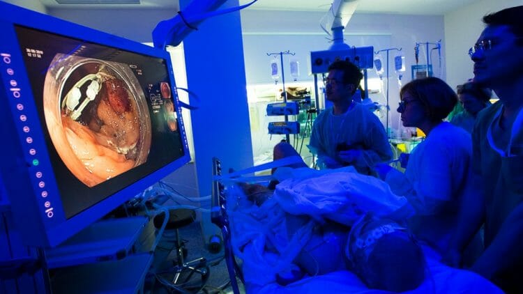 Riesgos de endoscopia