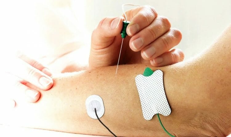 Electromiograma: para qué sirve y sus efectos secundarios