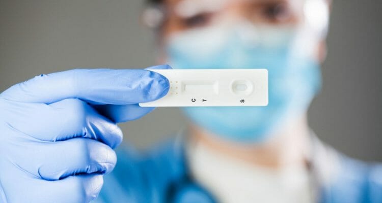 Prueba de antígenos