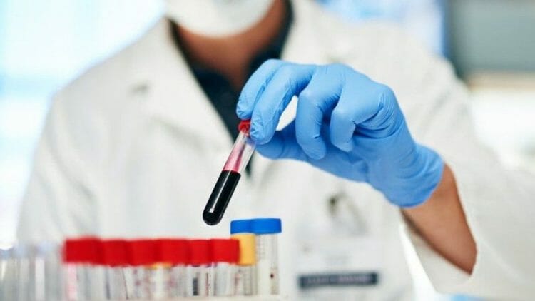 Cómo diagnosticar la neutropenia