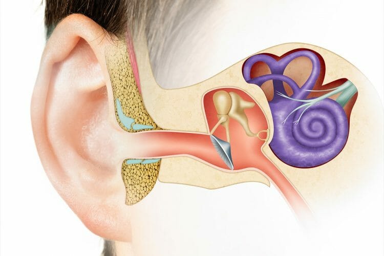 Que es la otitis