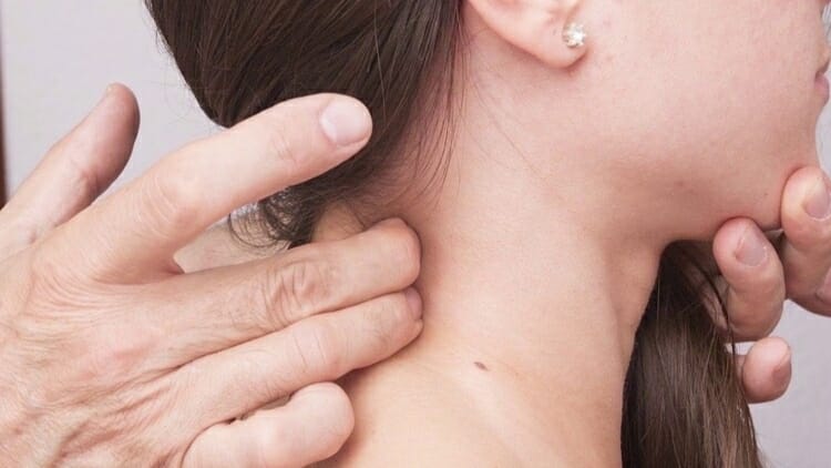 Ganglios inflamados: causas, síntomas y cuándo acudir al médico