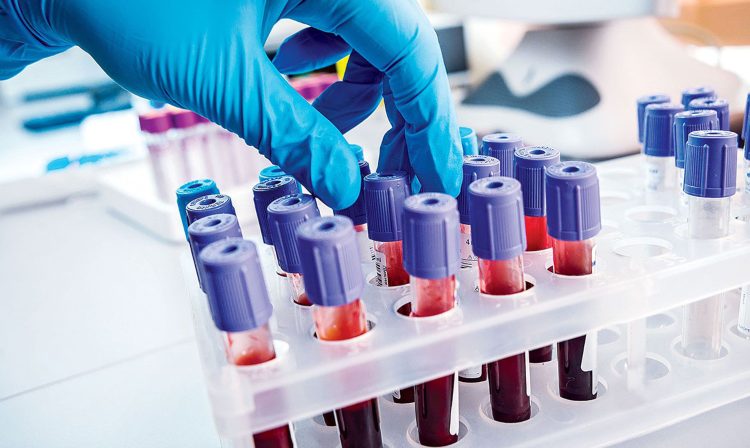 Hematocrito alto en sangre: causas y formas de bajarlo