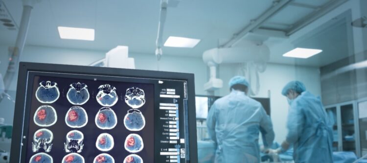 Ventajas del Neuronavegador