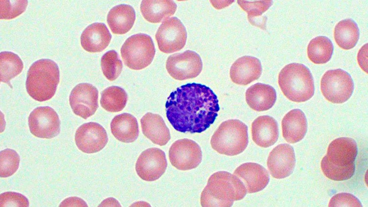 Basopenia