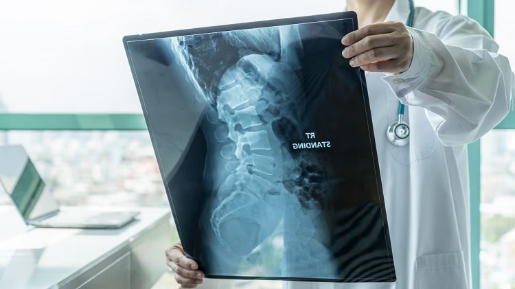 Cáncer de huesos