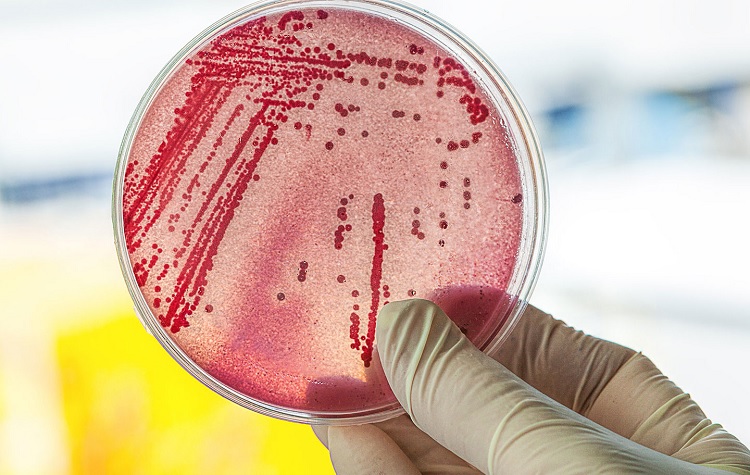 E coli