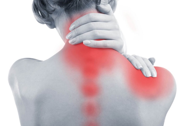 Causas del dolor en la nuca