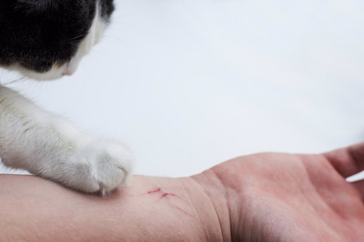 Enfermedad del arañazo del gato