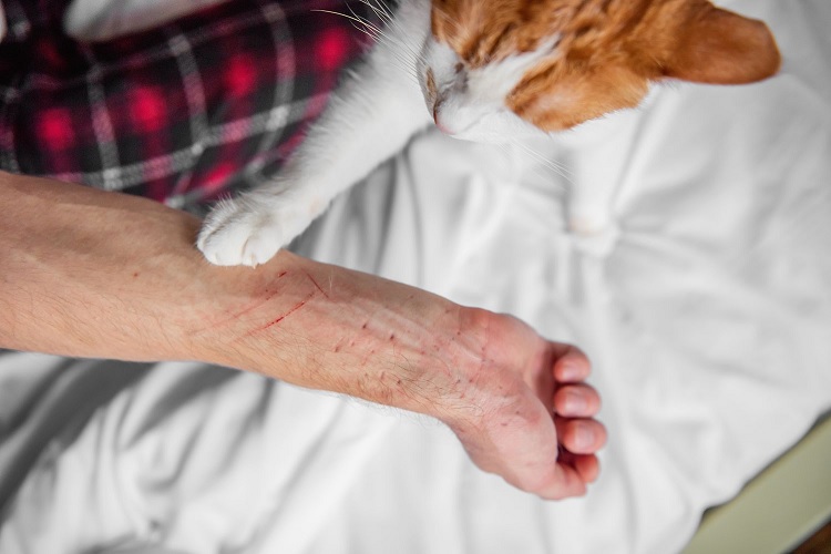 Enfermedad del arañazo del gato