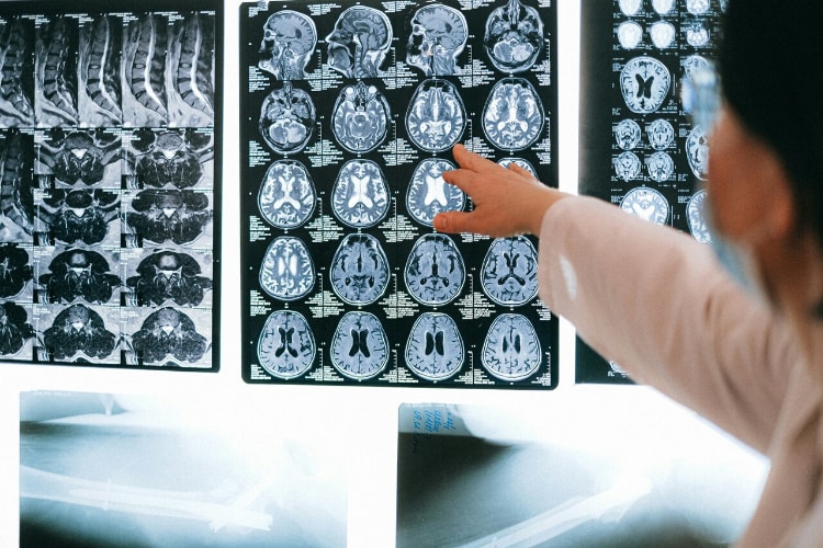 Explora Medicina Nuclear en Madrid con MEDAC