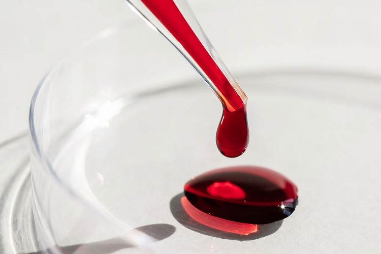 Proteínas bajas en sangre