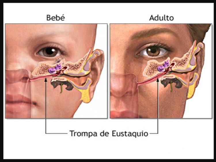 Problemas auditivos Otitis