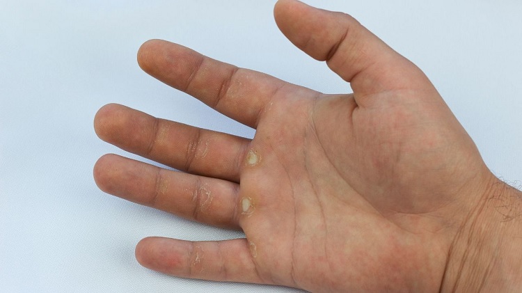 Ojo de pescado en la mano