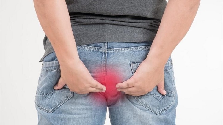 ¿Cómo curar hemorroides en 48 horas?