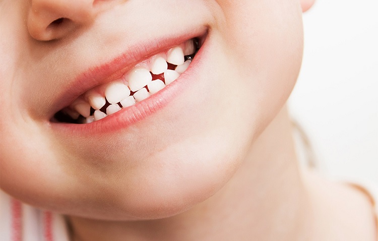 Cuidado dental infantil