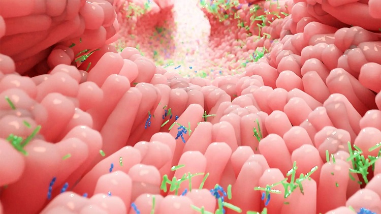 Disbiosis intestinal