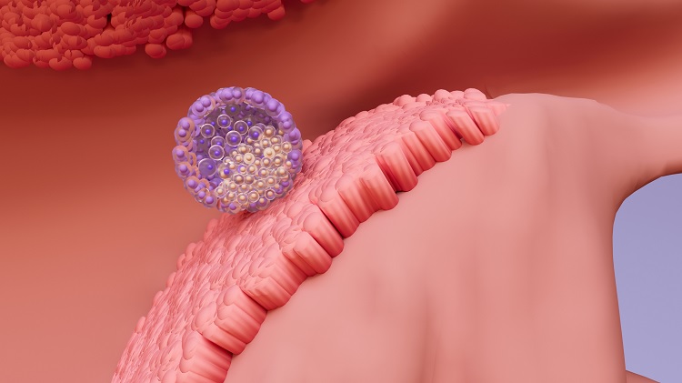 ¿Qué es el sangrado de implantación y por qué se produce?