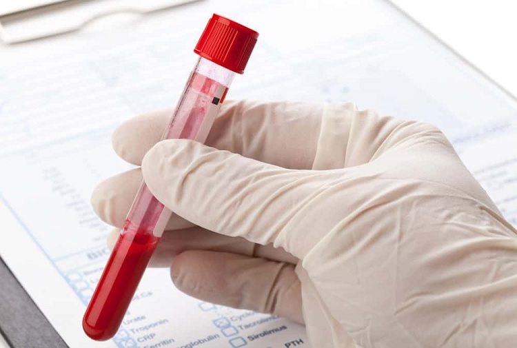 Análisis de sangre RDW