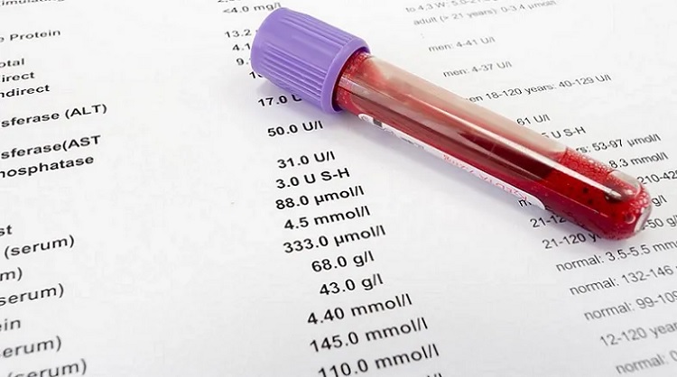 TIBC alto: qué significa y cómo disminuir este valor
