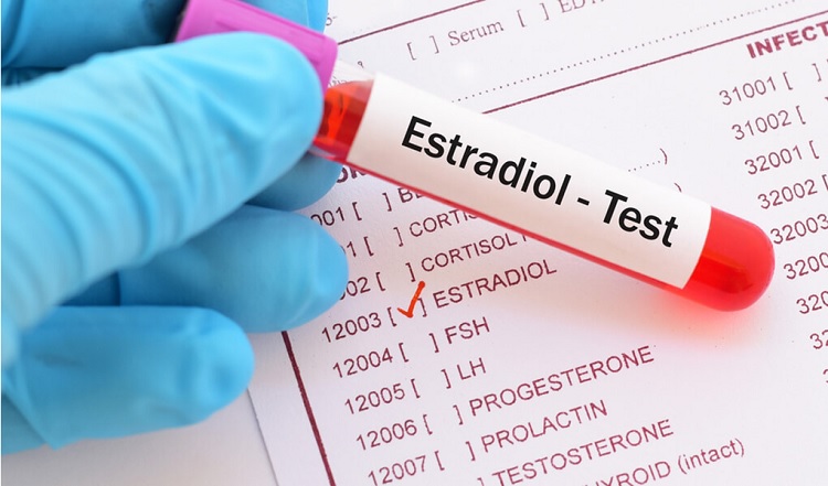 Estradiol alto: síntomas, causas y tratamiento