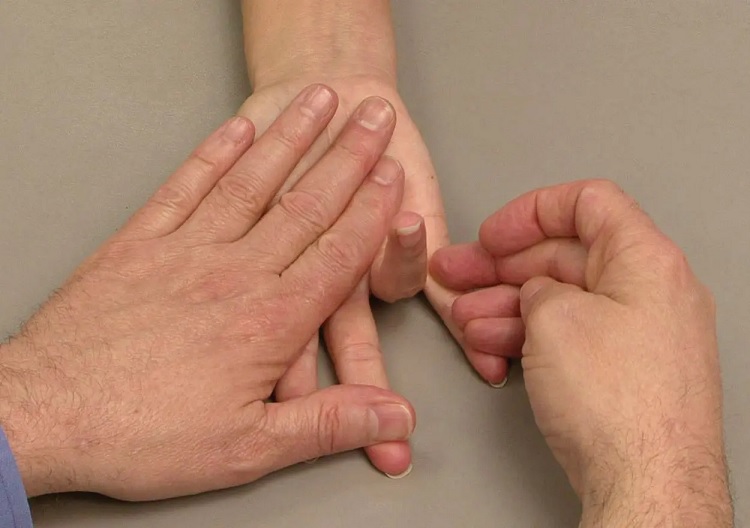 Protuberancias en los dedos de la mano