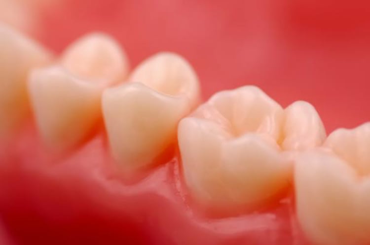 Problemas dentales
