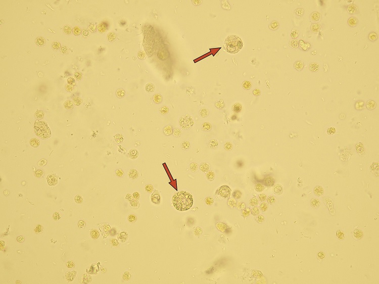 Leucocituria