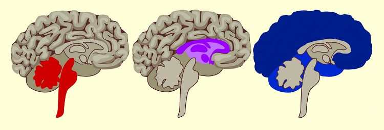 Cerebro triúnico
