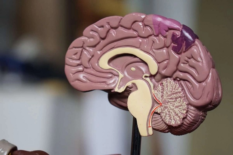 Cerebro