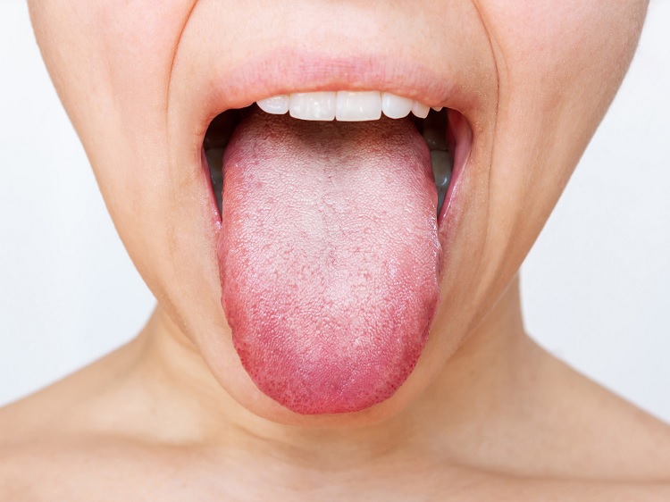 Lengua saburral