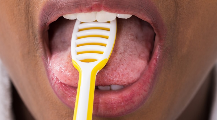Tratar lengua saburral
