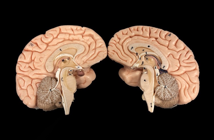 Hemisferios cerebrales