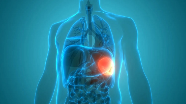 Vivir sin bazo: cuidados y consecuencias de una esplenectomía
