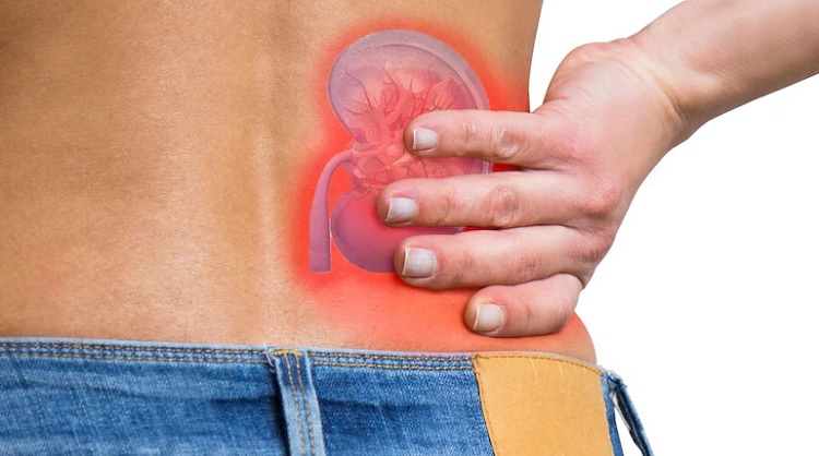 Causas del dolor de riñones y cómo diagnosticar