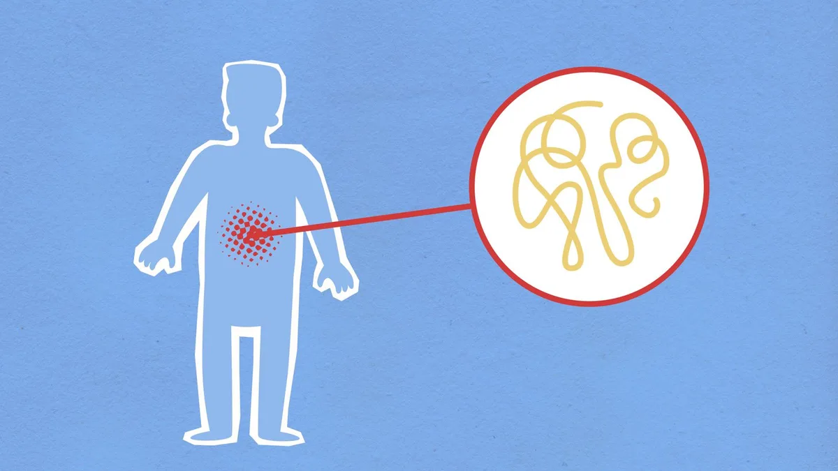 Helicobacter pylori: síntomas, contagio, diagnóstico y tratamiento