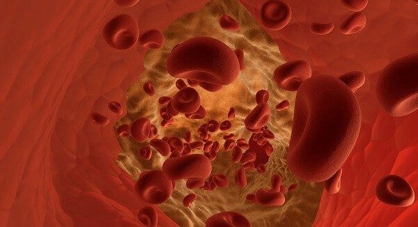 hemoglobina alta en sangre