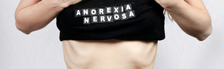 Anorexia nerviosa