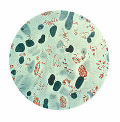 Bacteria que causa la lepra