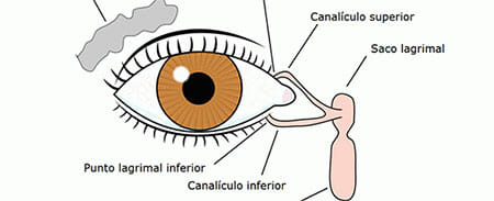 Dacriocistitis y sistema lacrimal