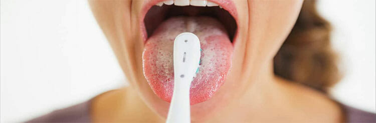 Limpieza e higiene de la lengua blanca