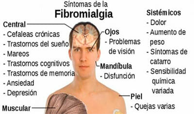 Síntomas de la fibromialgia
