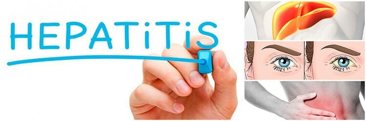 Síntomas de la hepatitis