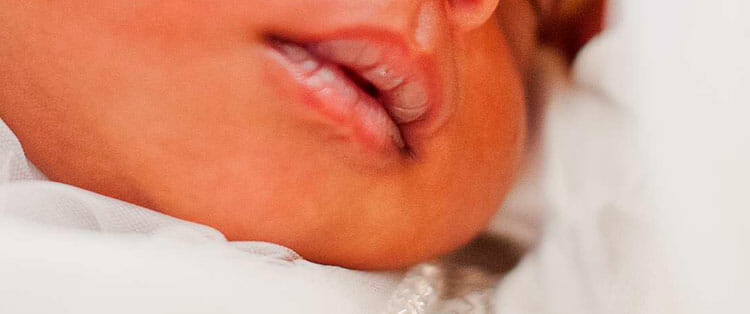 Bebé con labios oscuros