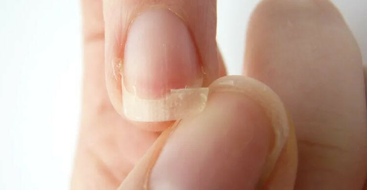 Señales de las uñas que indican problemas de salud graves