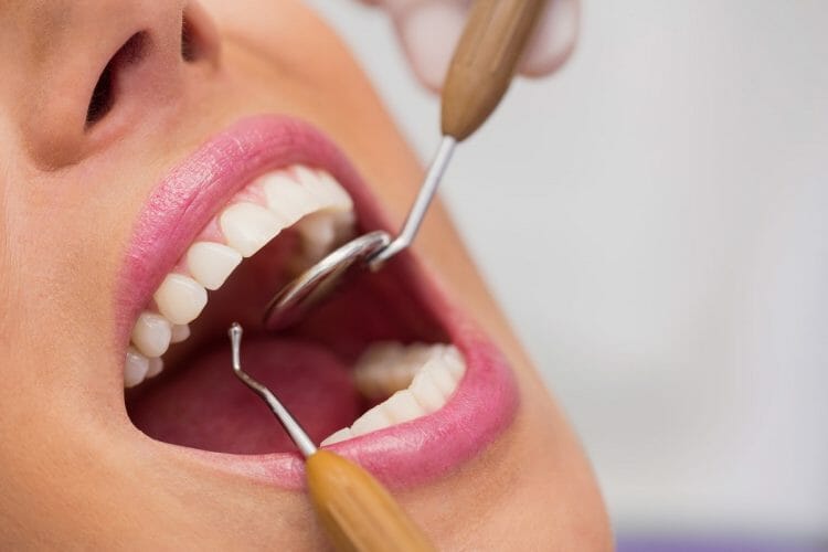 Qué es la estética dental